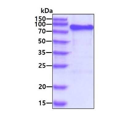 SDS-PAGE: Recombinant Human AMPD2 His Protein [NBP2-51884]